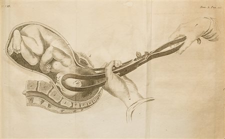 Ostetricia - Baudelocque, Jean Louis L'Art des Accouchemens Paris, Méquignon,...